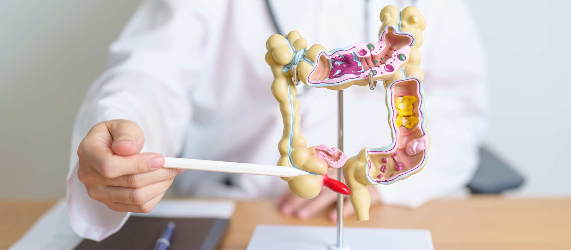 doenças inflamatórias intestinais