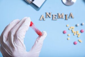 Anemia