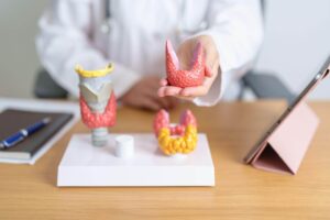 Médico segurando uma maquete da garganta humana com hipertireoidismo. 
